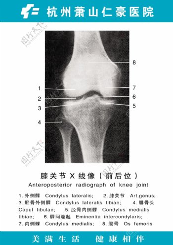 医疗人体科室挂图23膝关节X线像