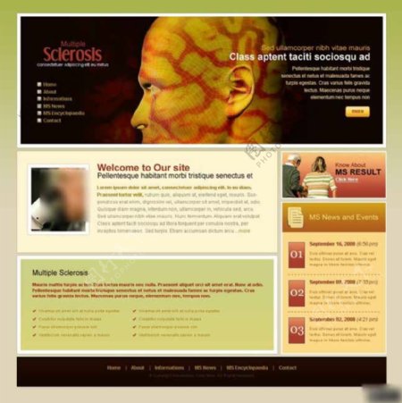 多发性硬化症治疗网页模板