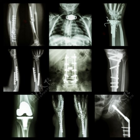 人体X光片图片