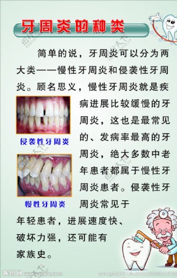 牙周炎的种类图片