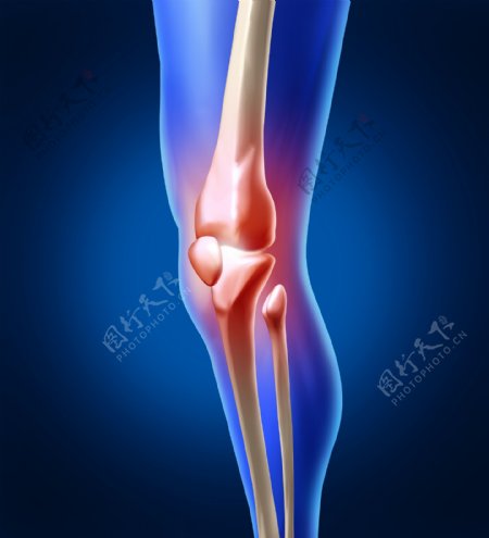 膝关节疼痛图片