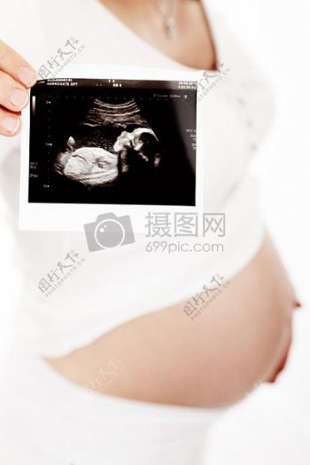 怀孕妈妈手中的婴儿照片