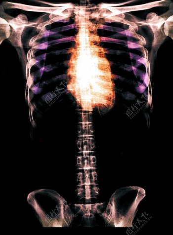 骨骼透视X光科技身躯胸图片