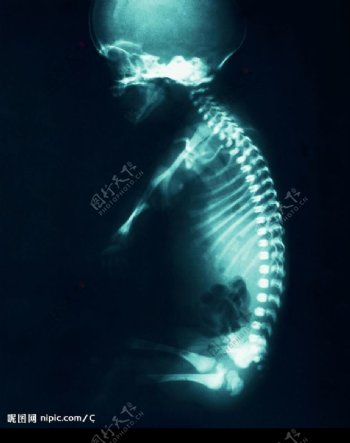 脊椎的X光图片