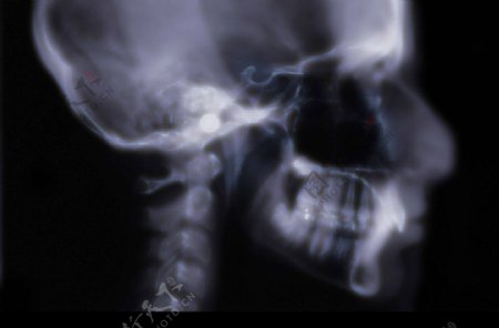 X光化验片图片
