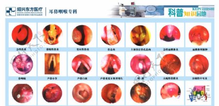 耳鼻喉图谱图片