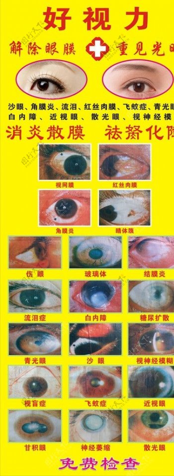 治疗眼睛常见症状易拉宝图片