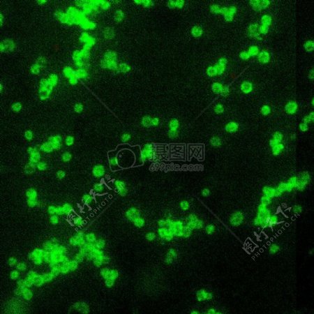 土拉弗朗西斯菌所看到与直接荧光抗体染色DFA