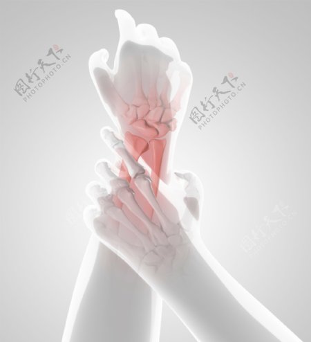 人体手腕X光图像图片